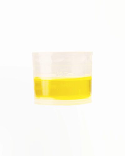 OmegaSOL: Vegán Omega 3 + D3 vitamin (150 ml), MoleQlar